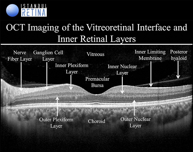 layers of the retina