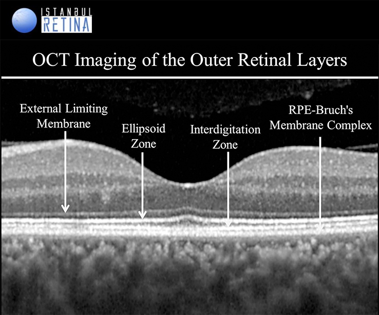 retinal layers oct